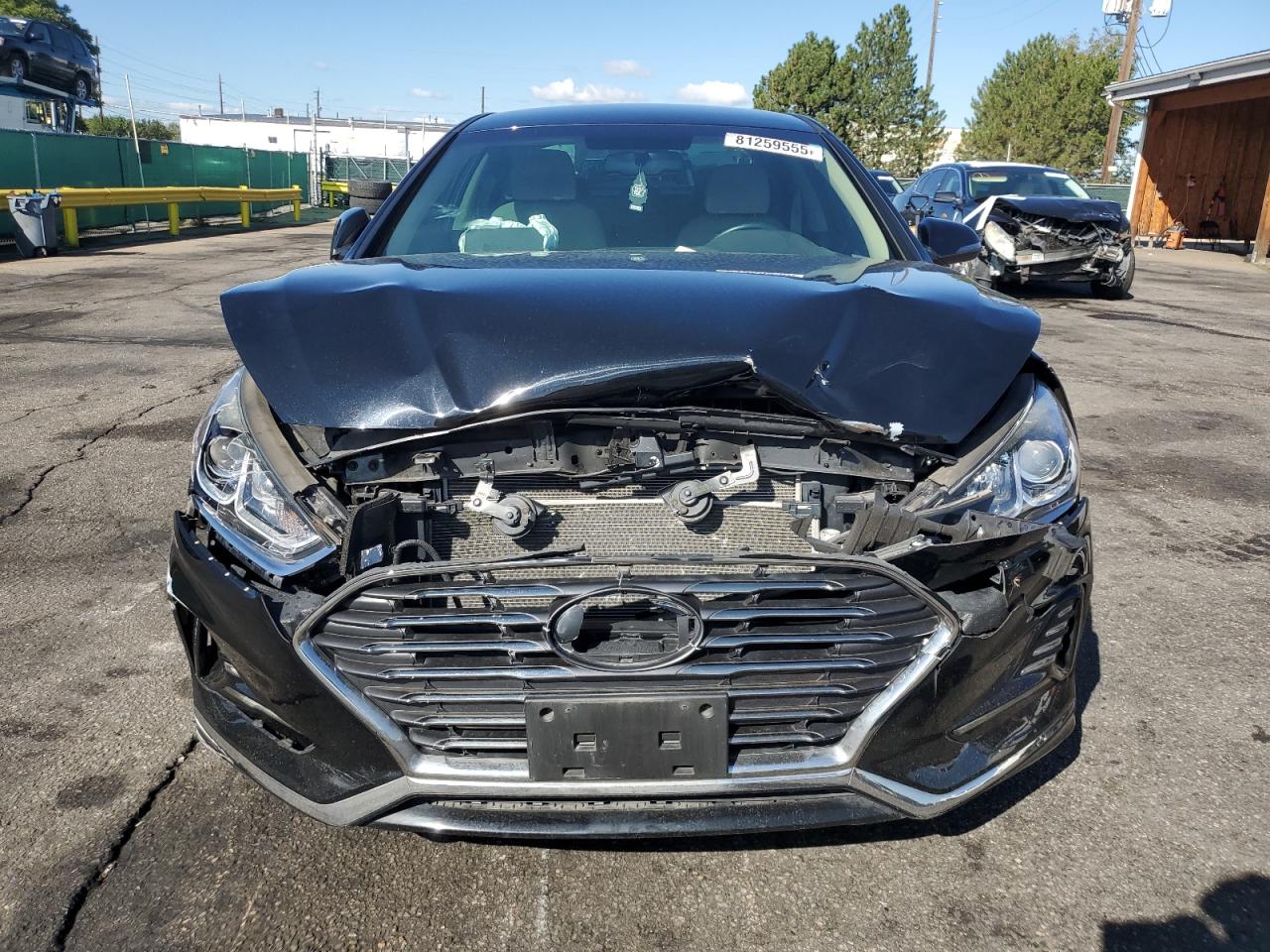 Hyundai SONATA Sport Image 2